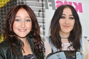 Noah Cyrus and Plastic Surgery: What's the Real Story?