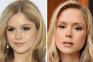 Erin Moriarty Plastic Surgery: What Fans Are Talking About