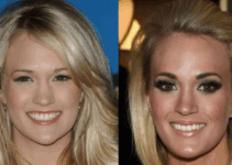 Carrie Underwood Plastic Surgery: What Fans Are Saying