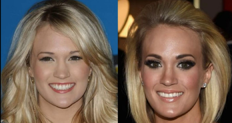 Carrie Underwood's Transformation: A Look at Her Changing Appearance