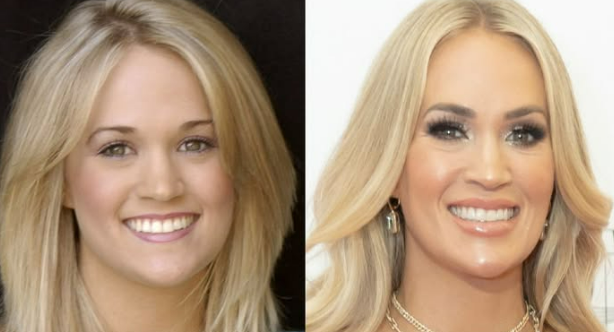 Celebrity Culture: The Impact of Carrie Underwood's Surgery Speculations