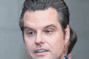 Matt Gaetz Plastic Surgery: What You Need to Know Now