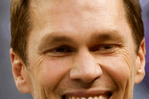 Tom Brady's Plastic Surgery: What Fans Are Saying