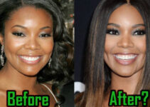 Gabrielle Union Plastic Surgery: What We Know So Far