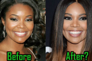 Gabrielle Union Plastic Surgery: What We Know So Far