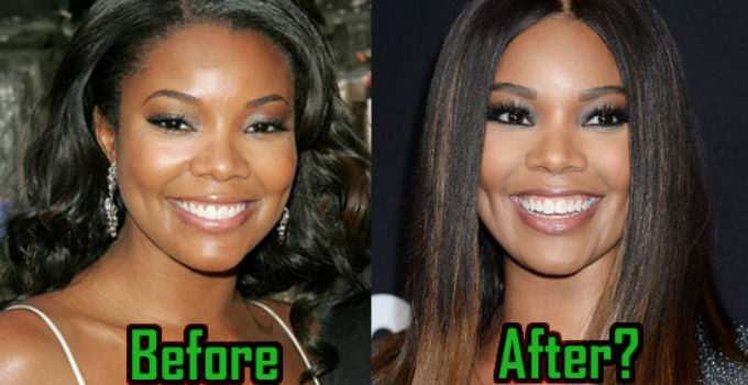 The Impact of Gabrielle Union's Plastic Surgery on Her Career