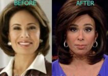 Judge Jeanine Plastic Surgery: What We Know So Far