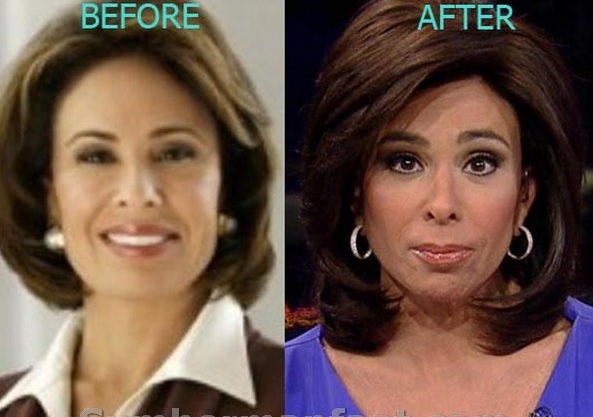 Public Reactions: Judge Jeanine's Plastic Surgery and Media Buzz