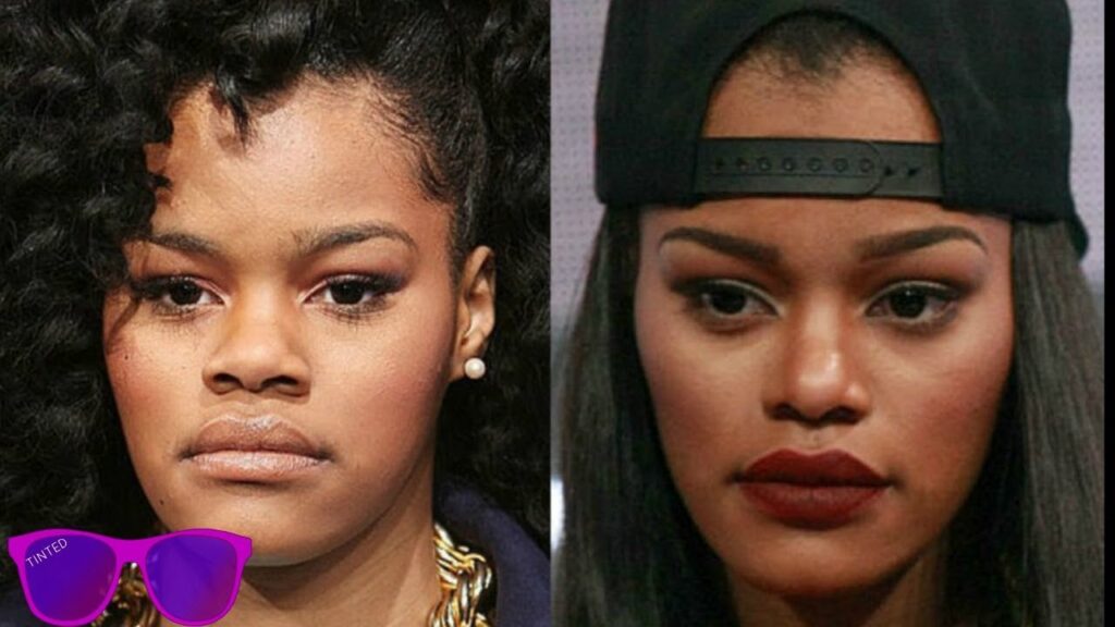 Teyana Taylor Plastic Surgery: Changes That Sparked Buzz