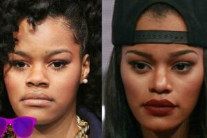 Teyana Taylor Plastic Surgery: Changes That Sparked Buzz